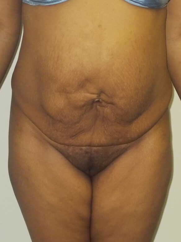 Before Image
