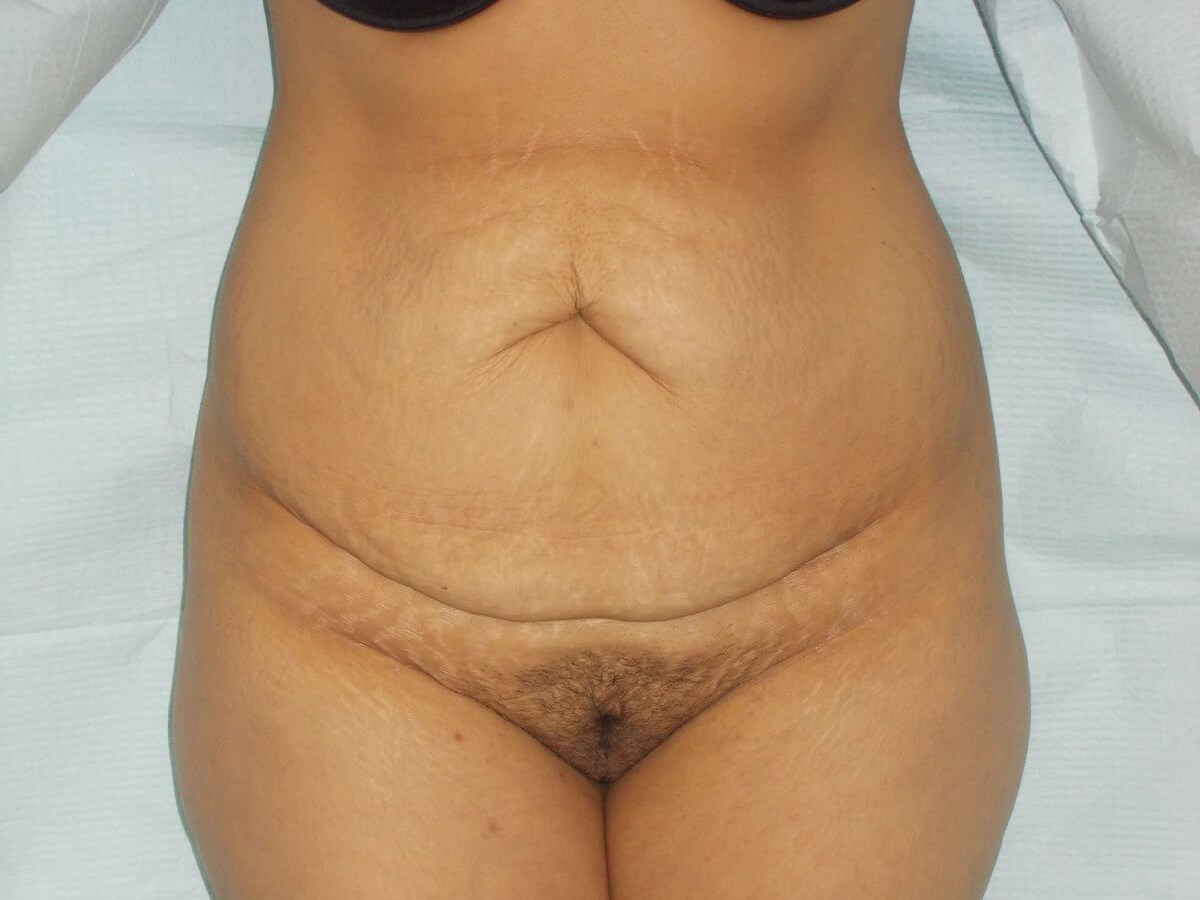 Before Image