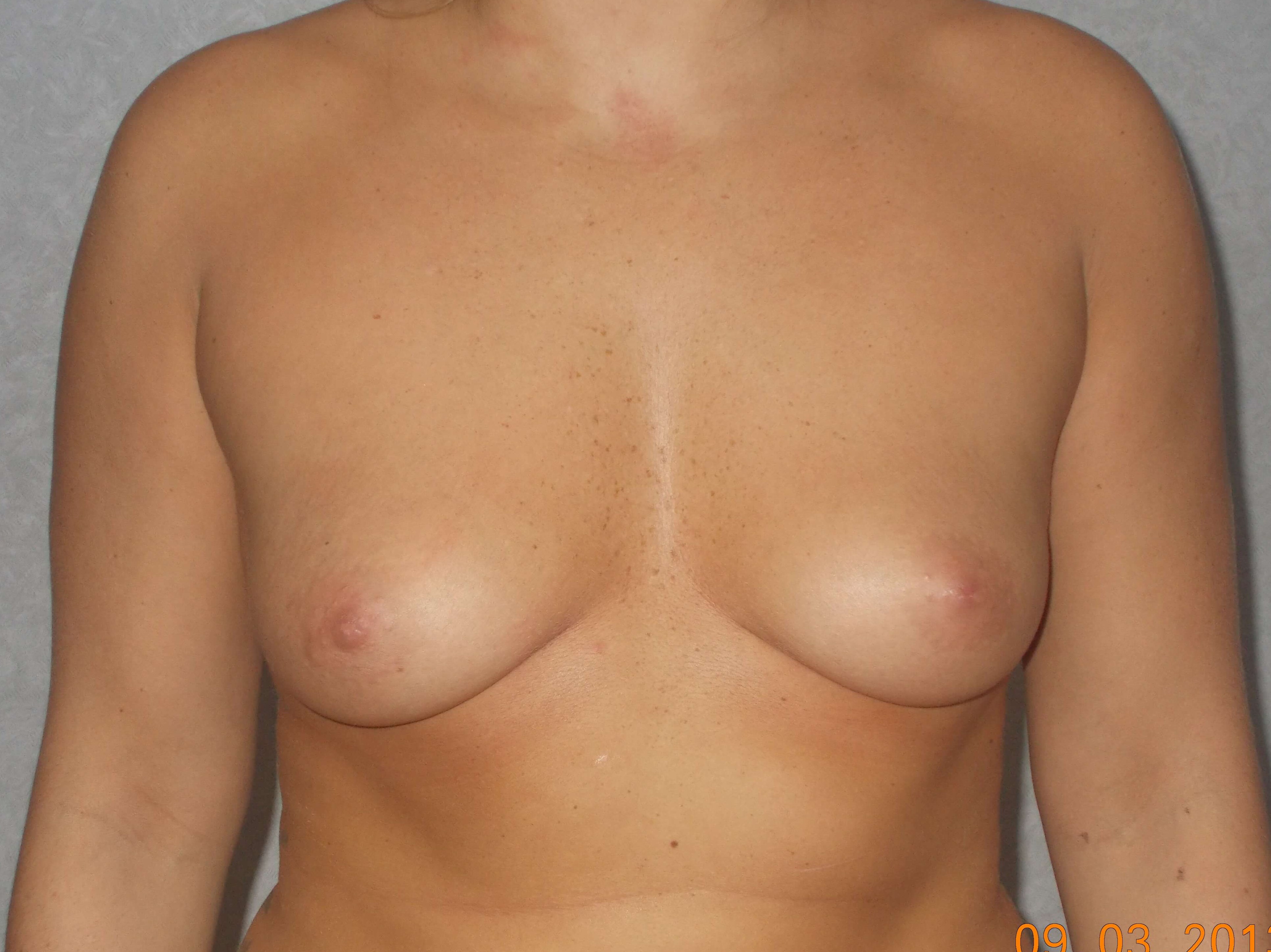 Before Image