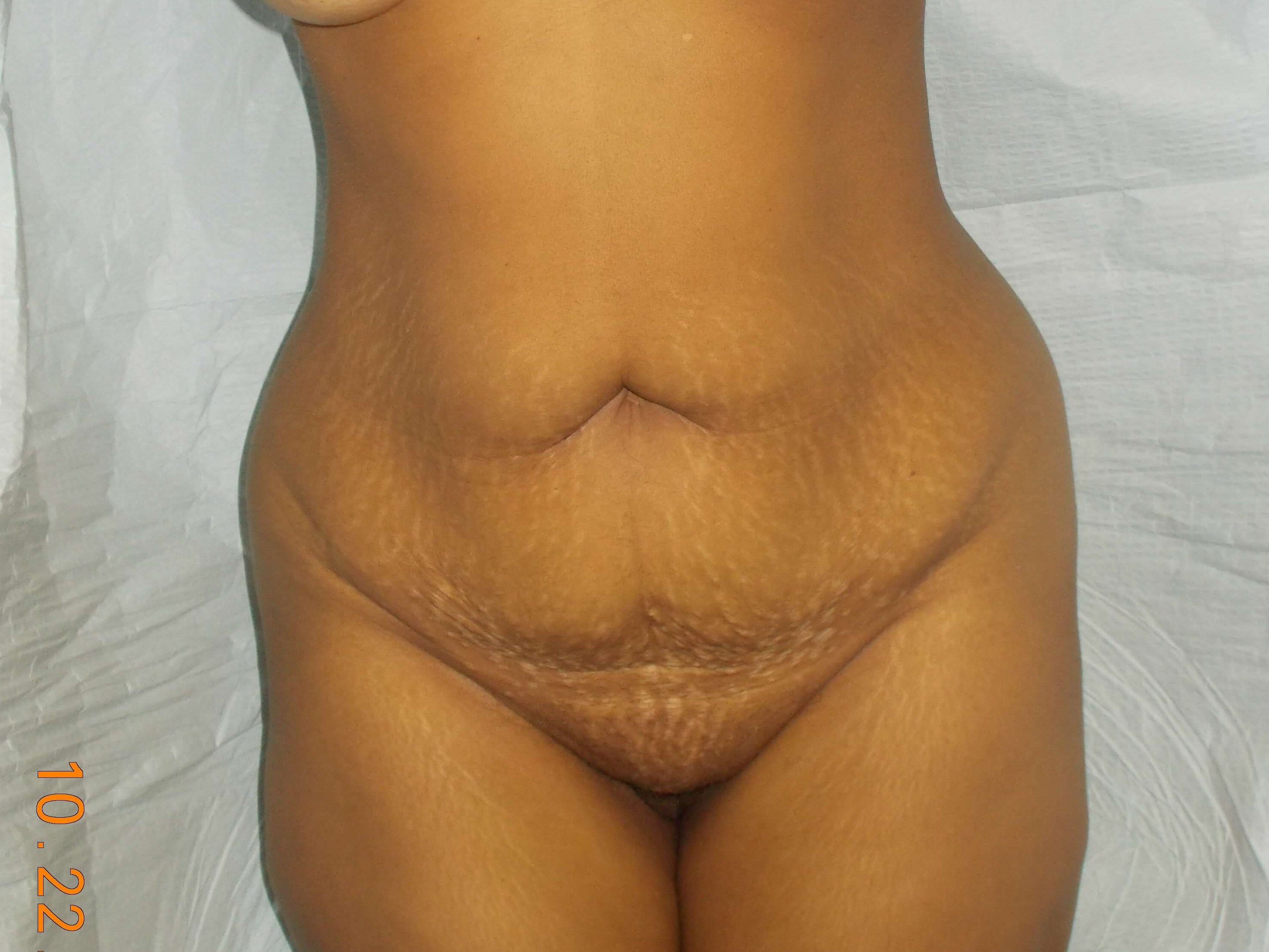 Before Image
