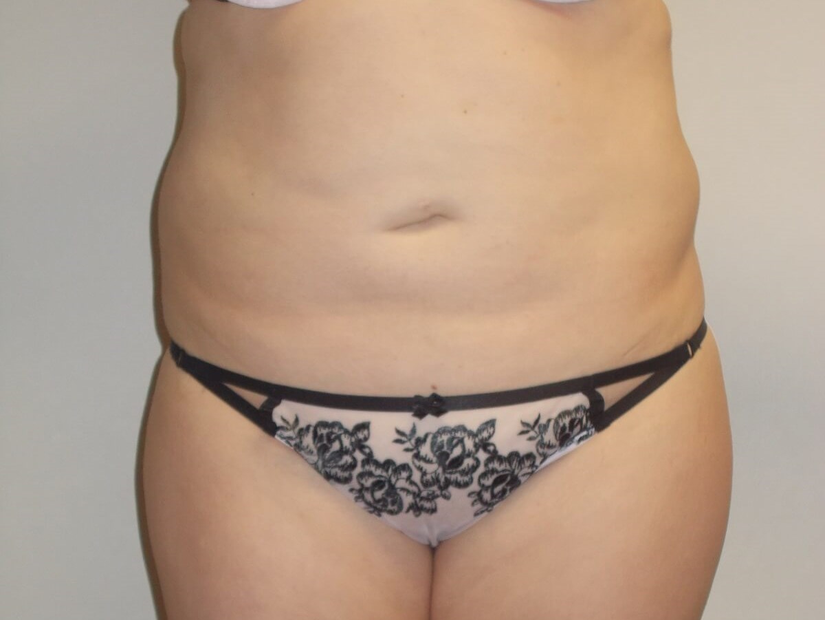 Before Image