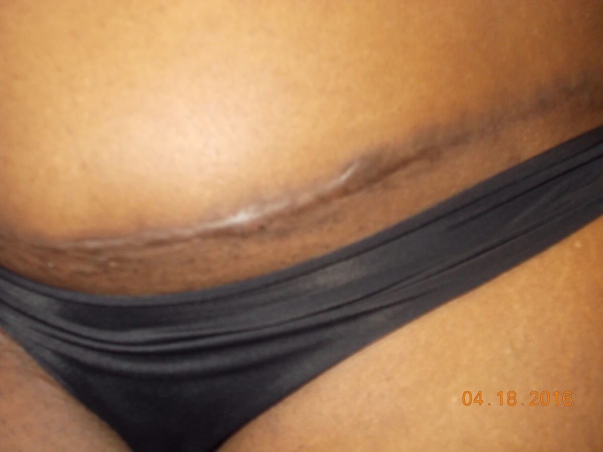 Before Image