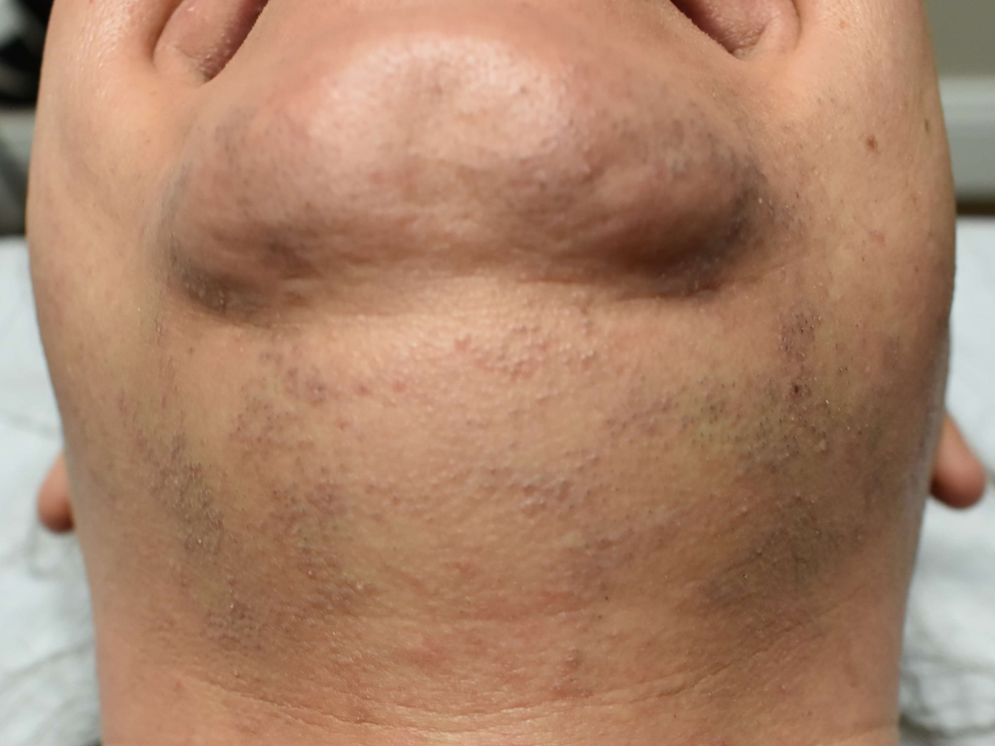 Before Image