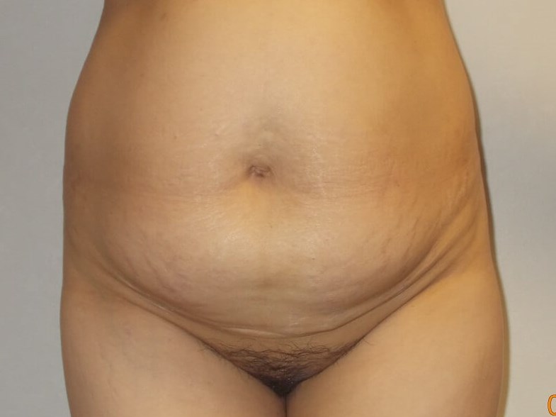 Before Image
