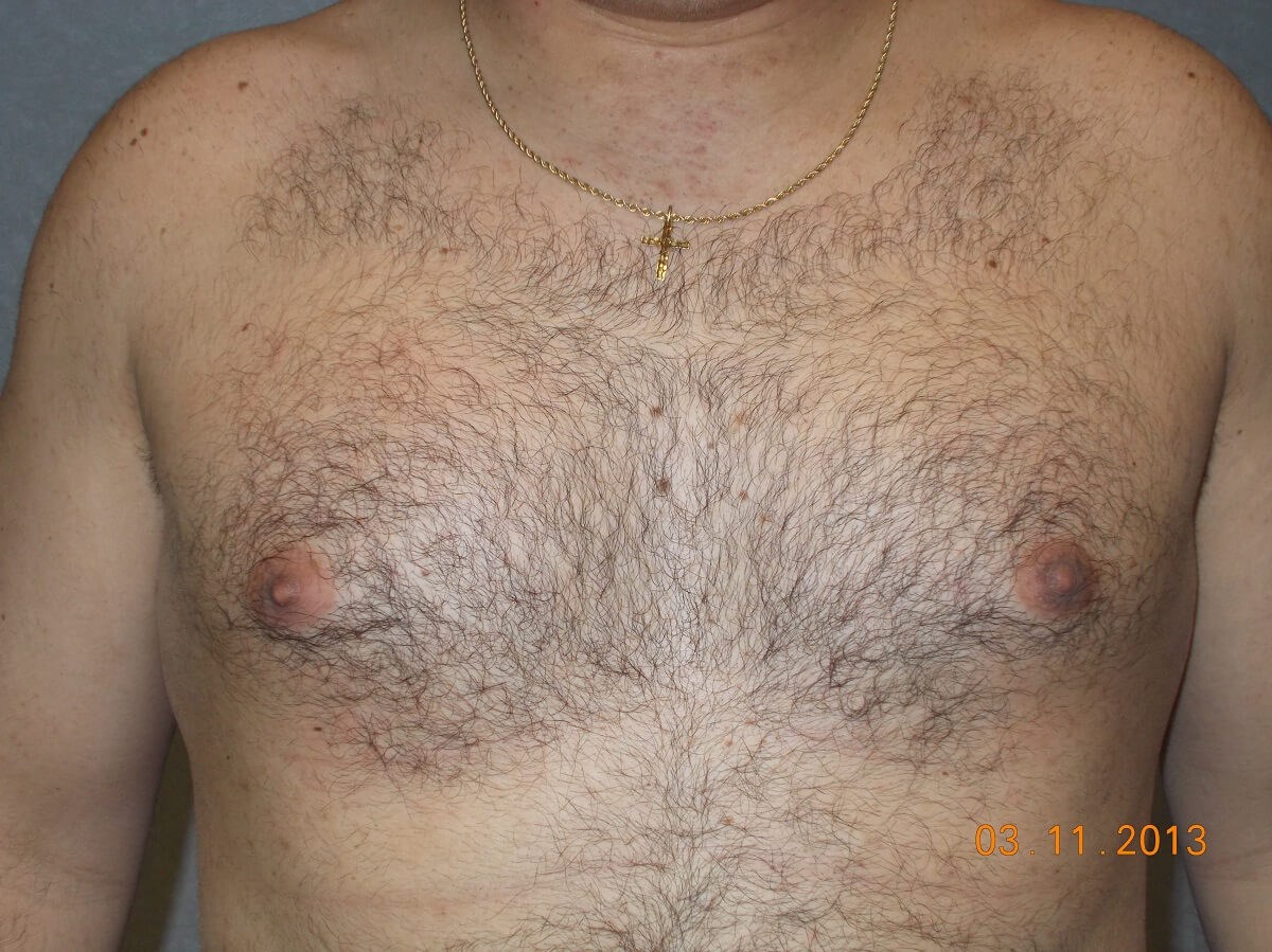 Before Image