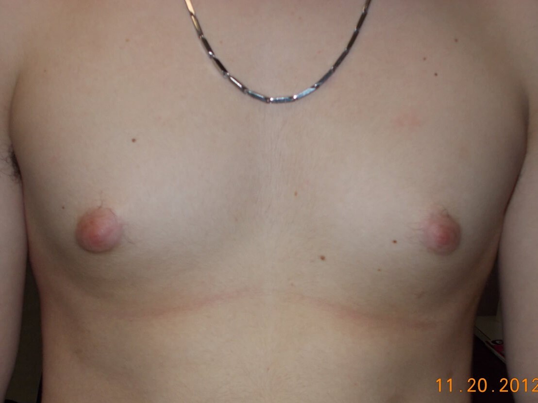 Before Image