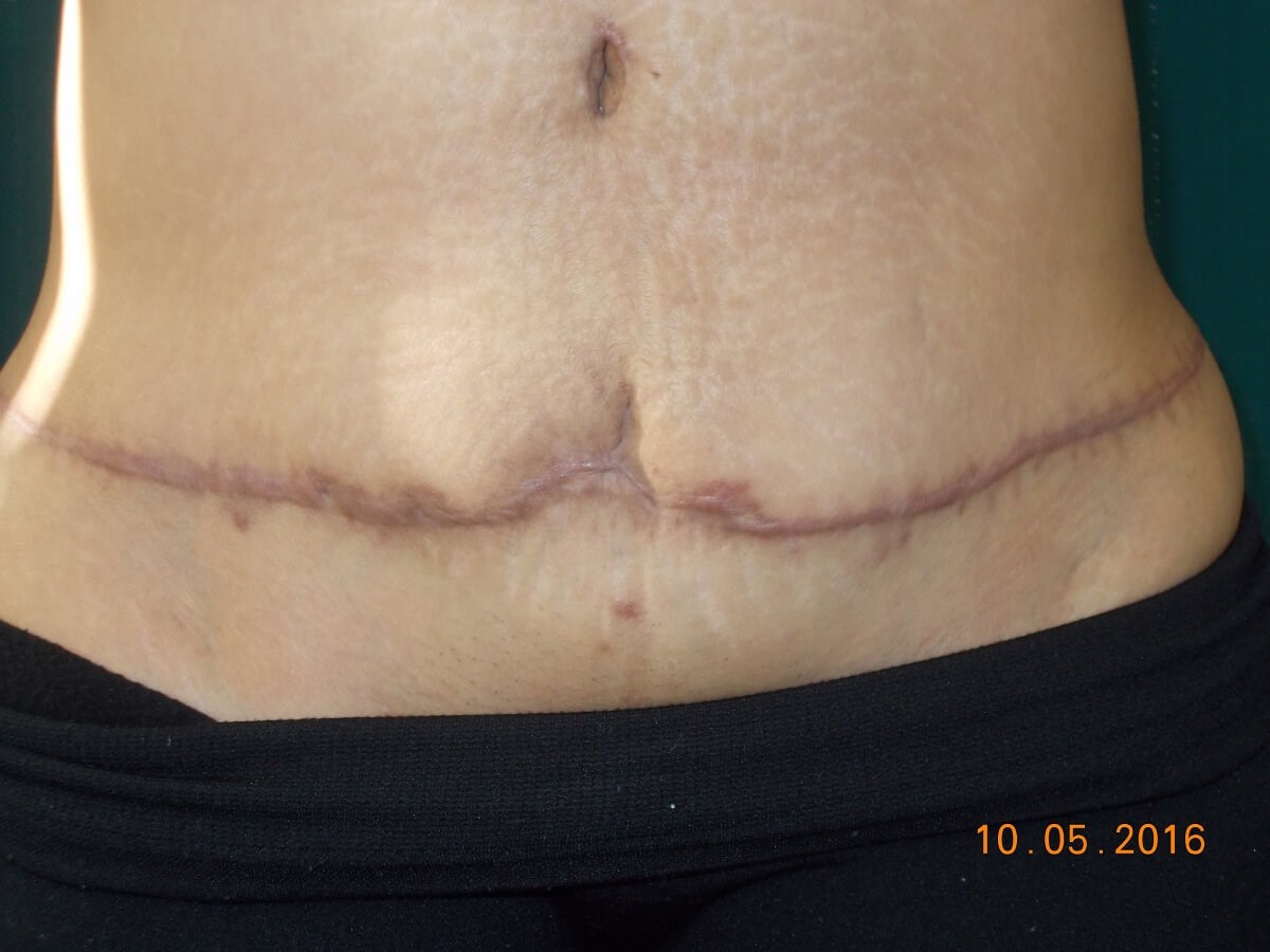 Before Image