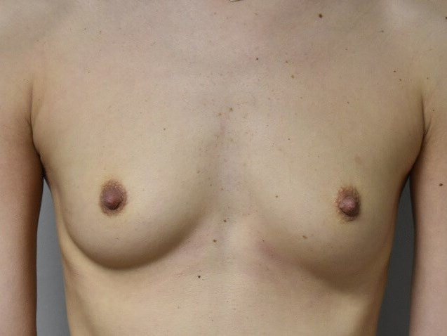 Before Image
