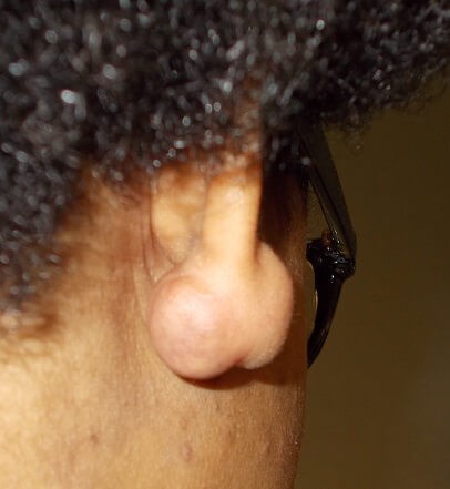 Before Image