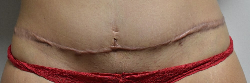 Before Image