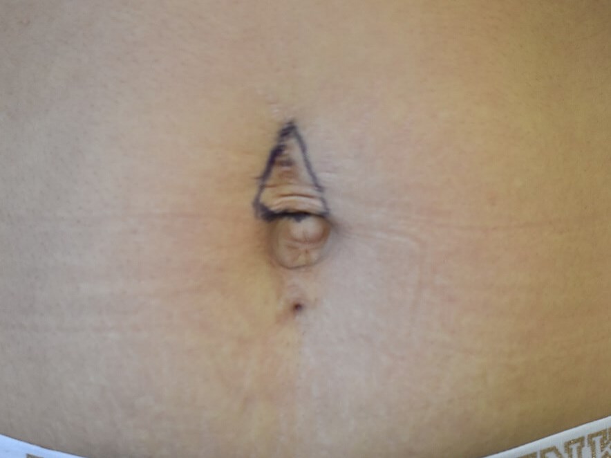 Before Image