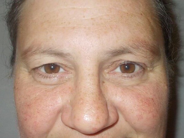 Before Image