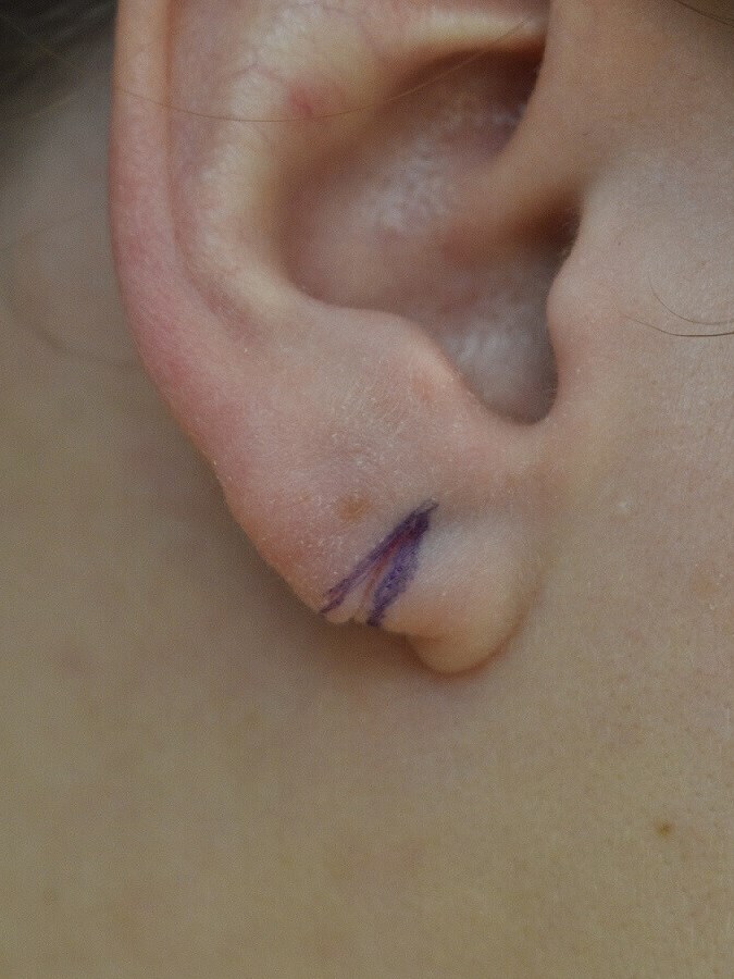Before Image