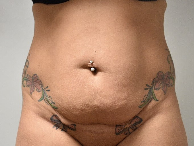 Before Image