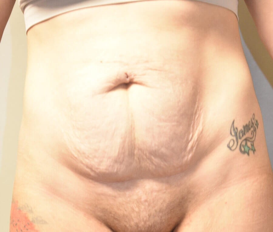 Before Image