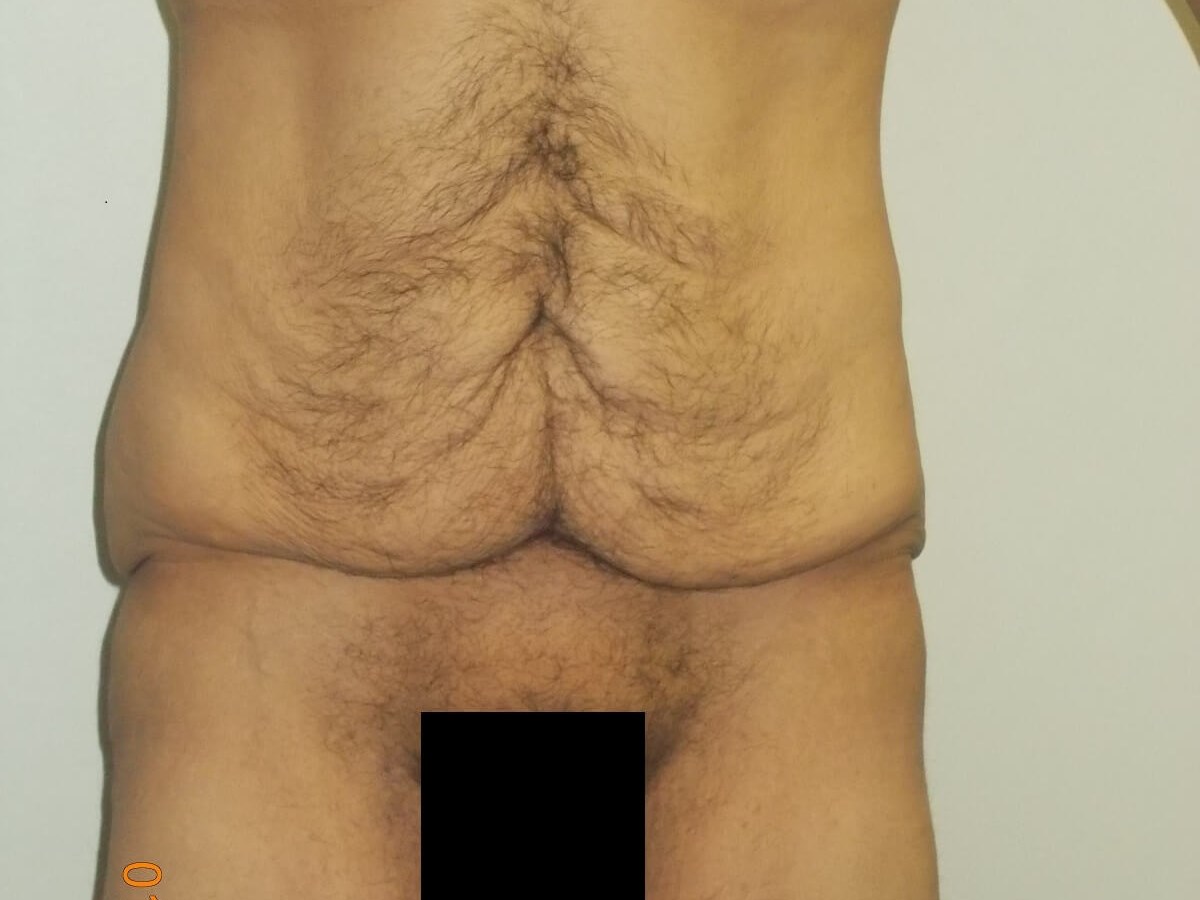 Before Image