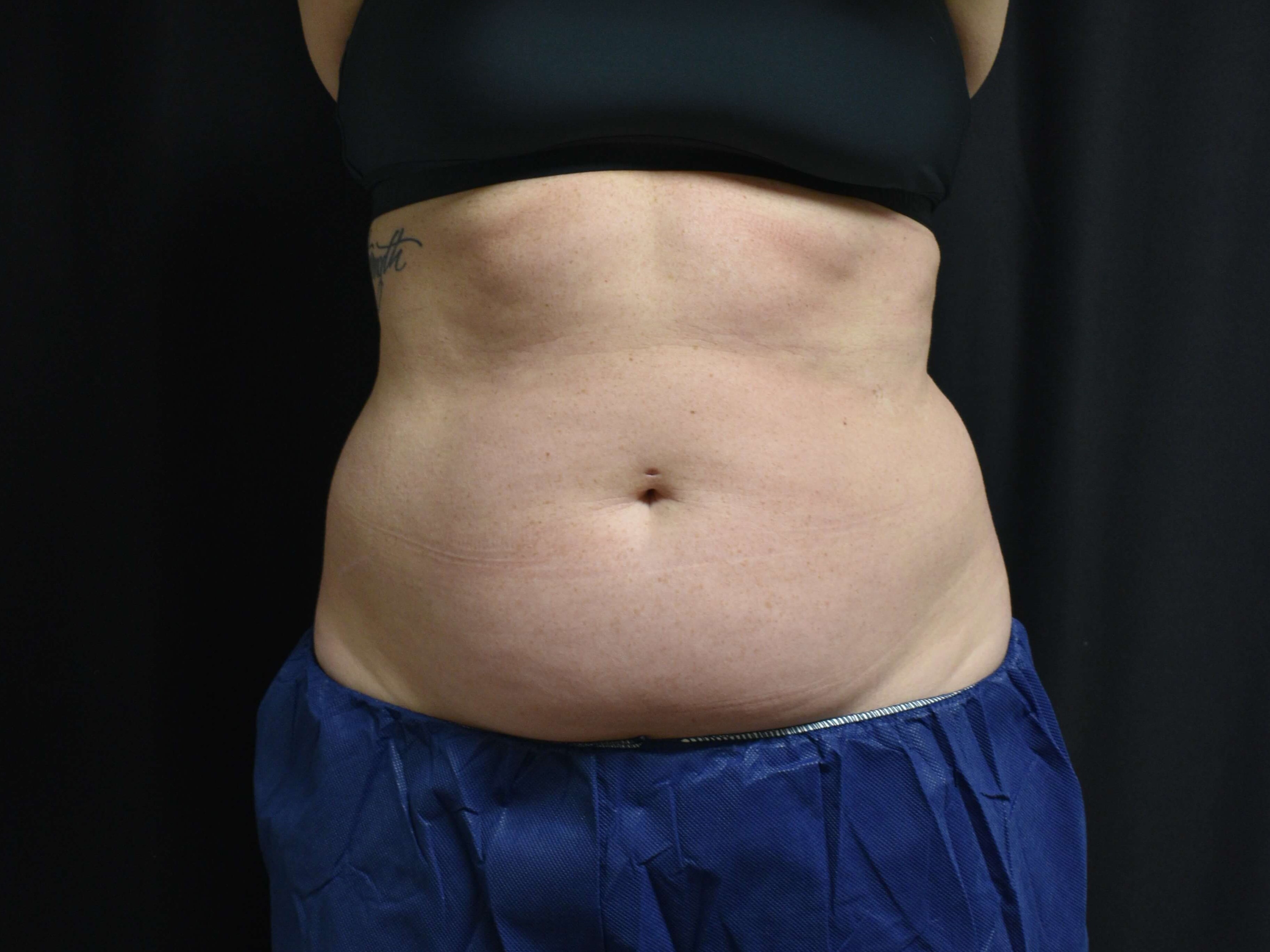 Before Image