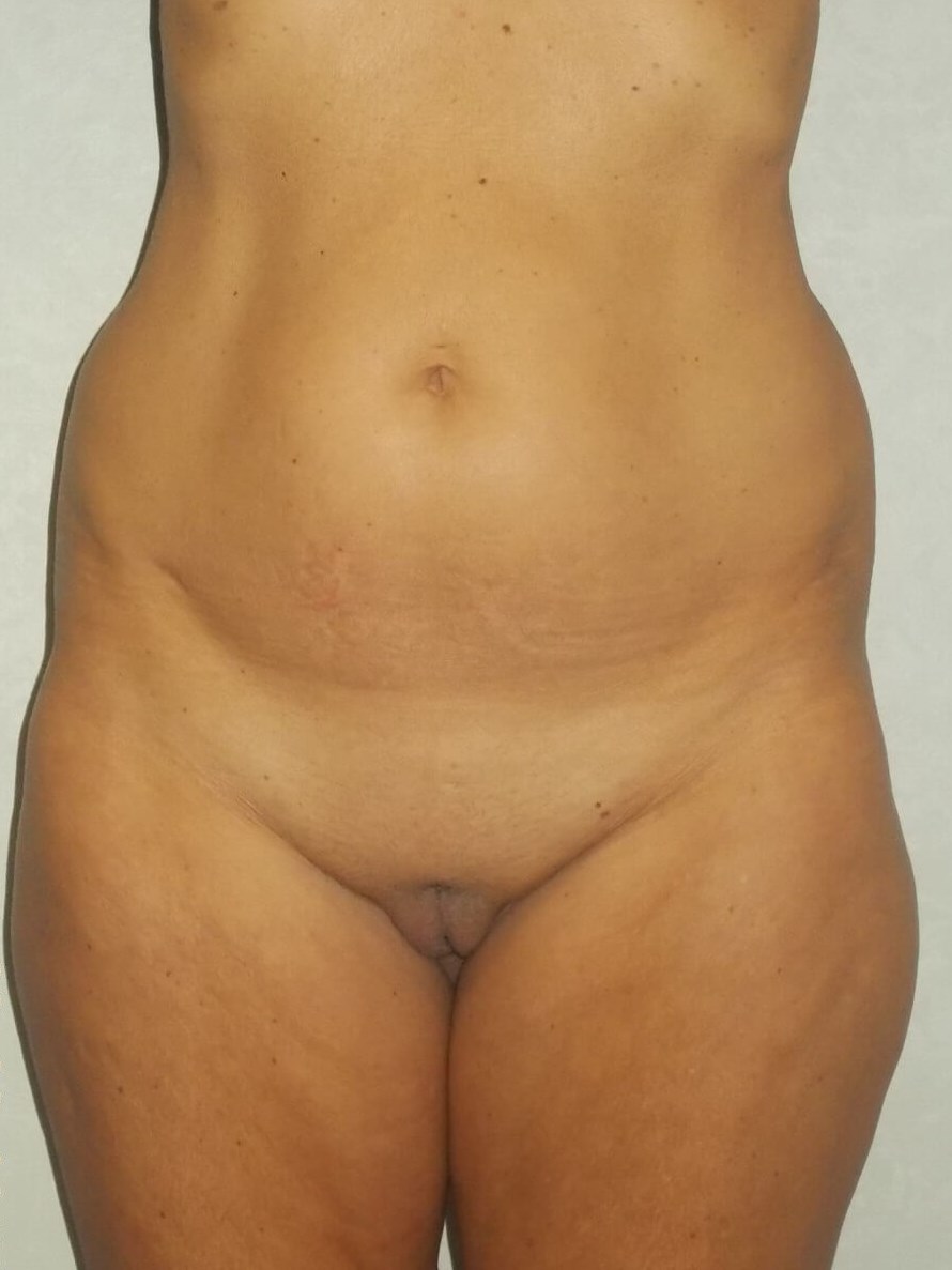 Before Image
