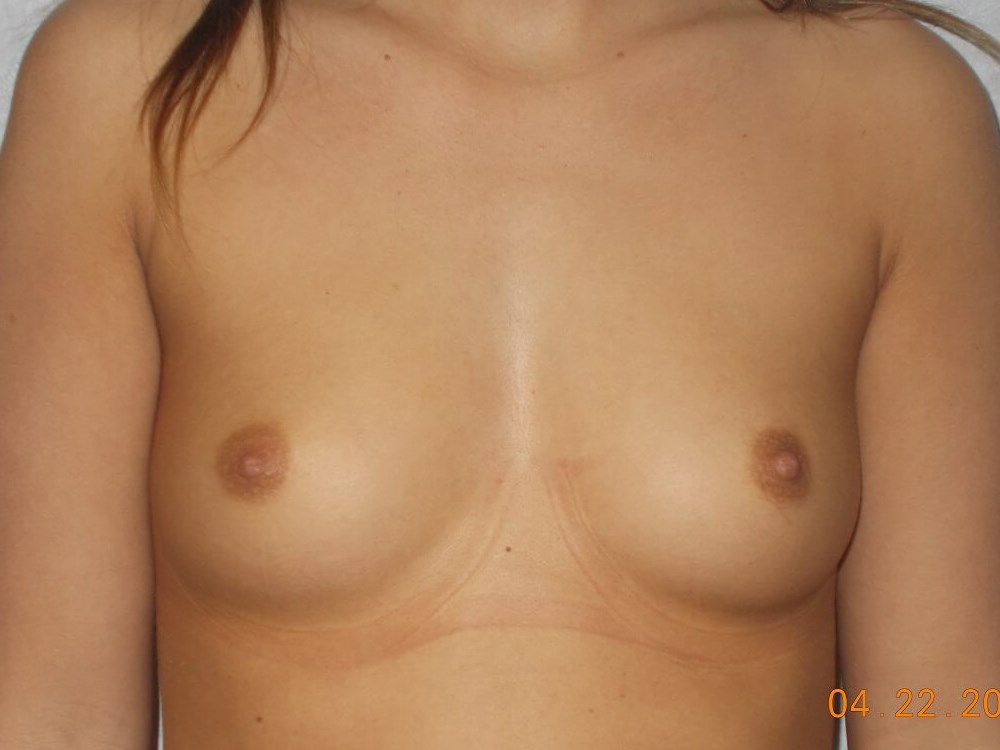 Before Image