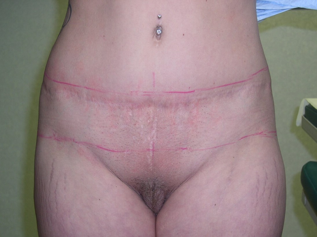 Before Image