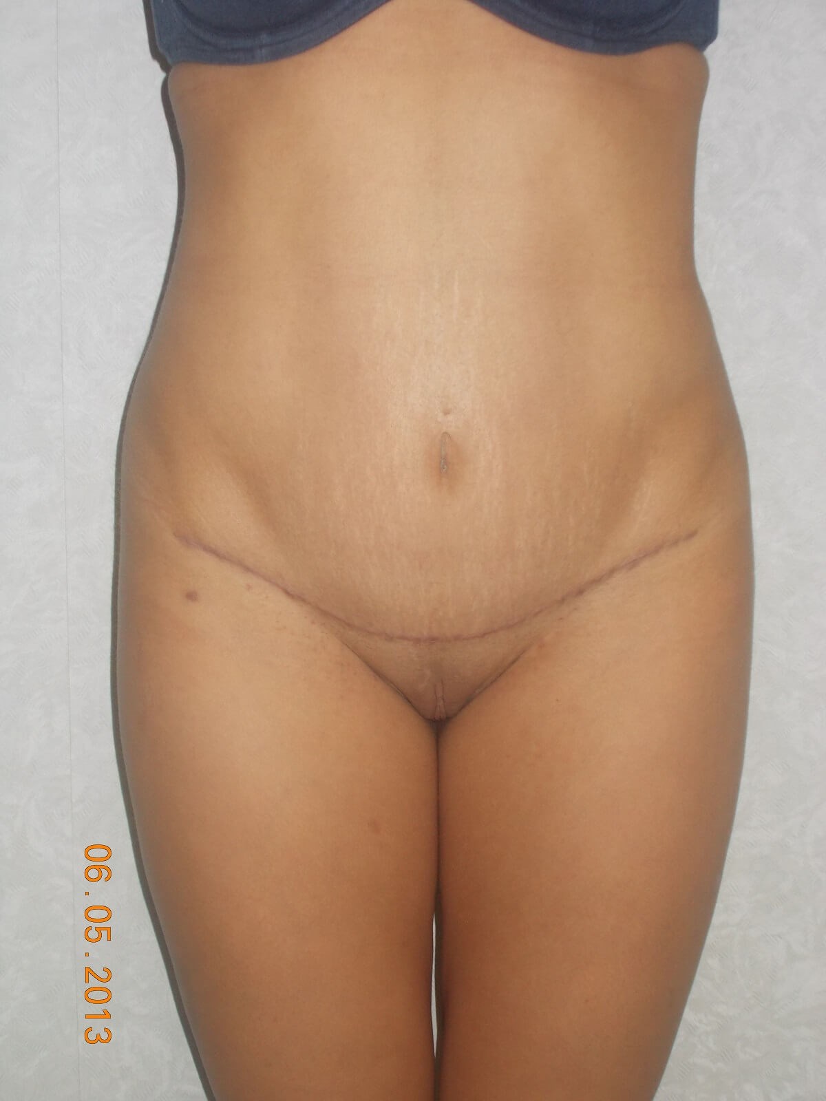 After Image