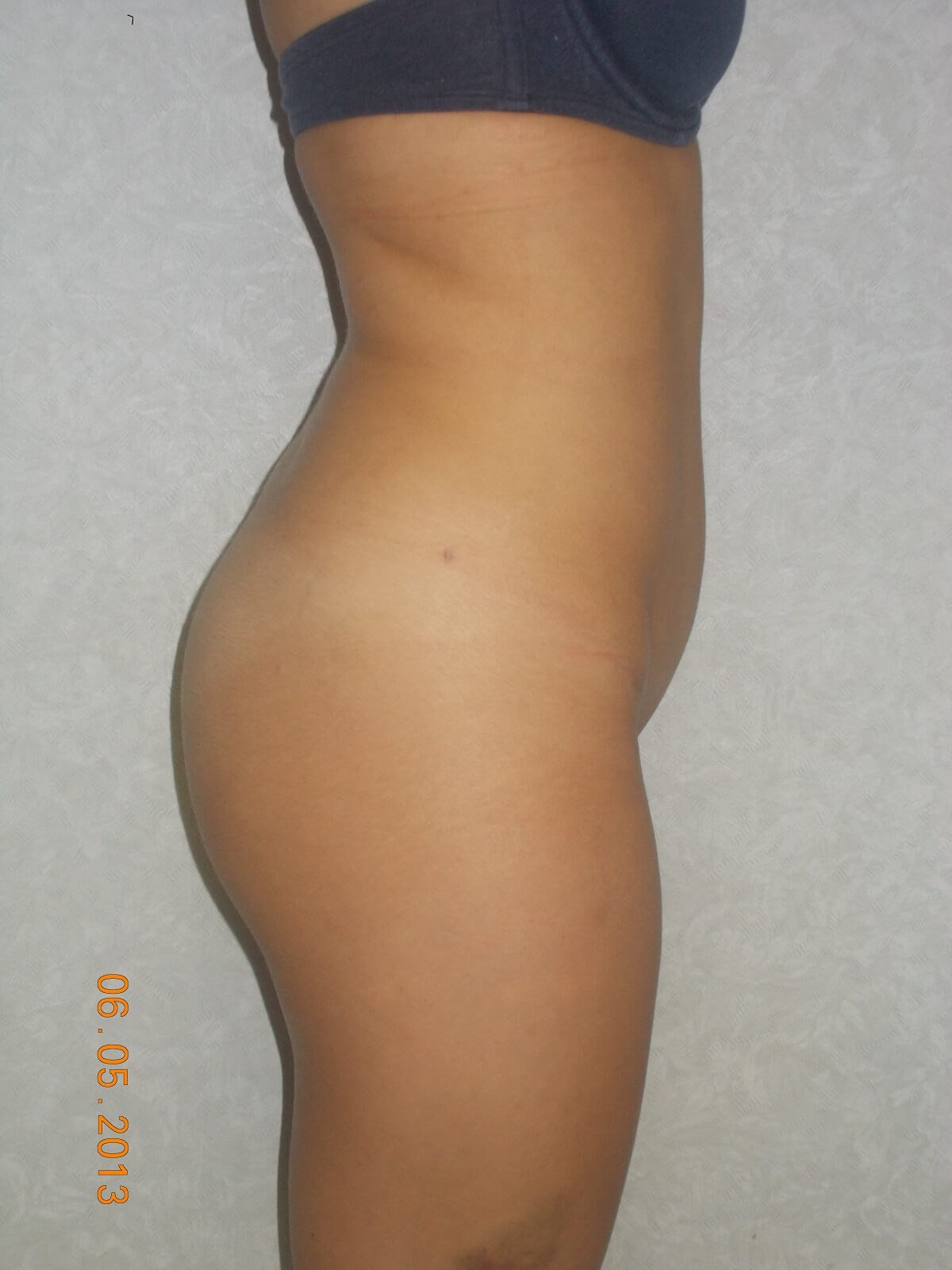 Side View After