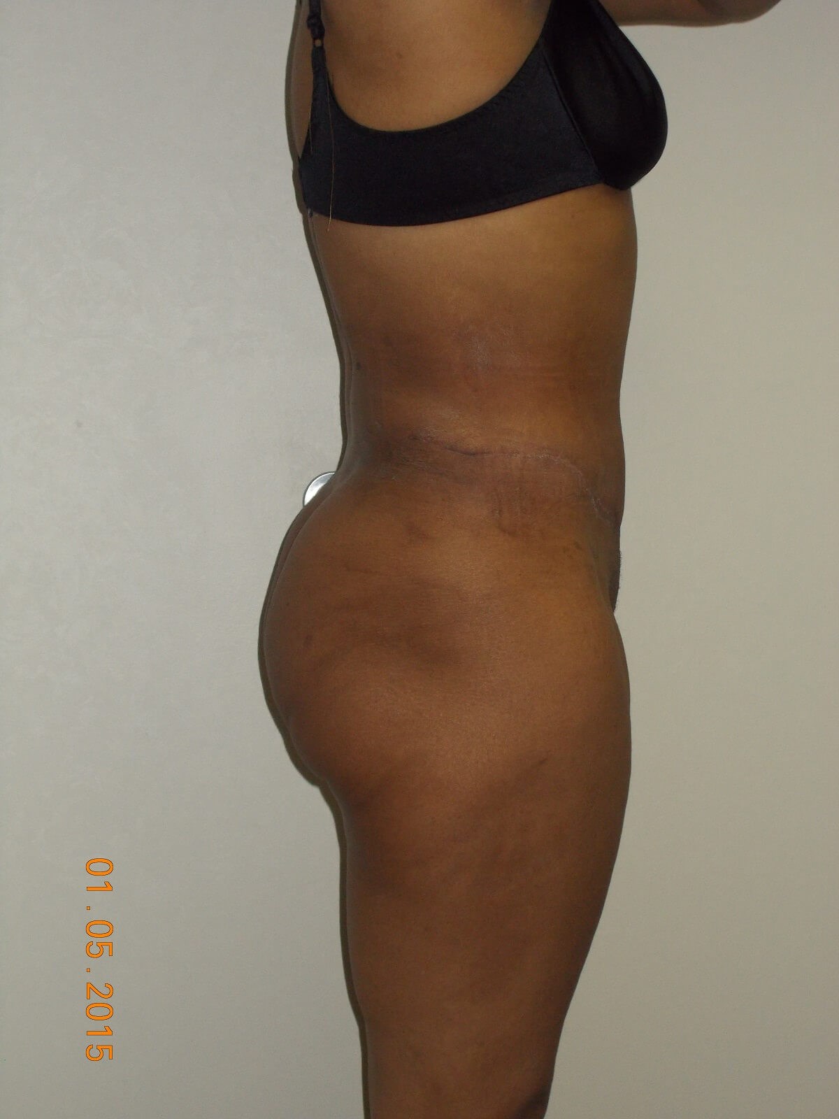 Side View After