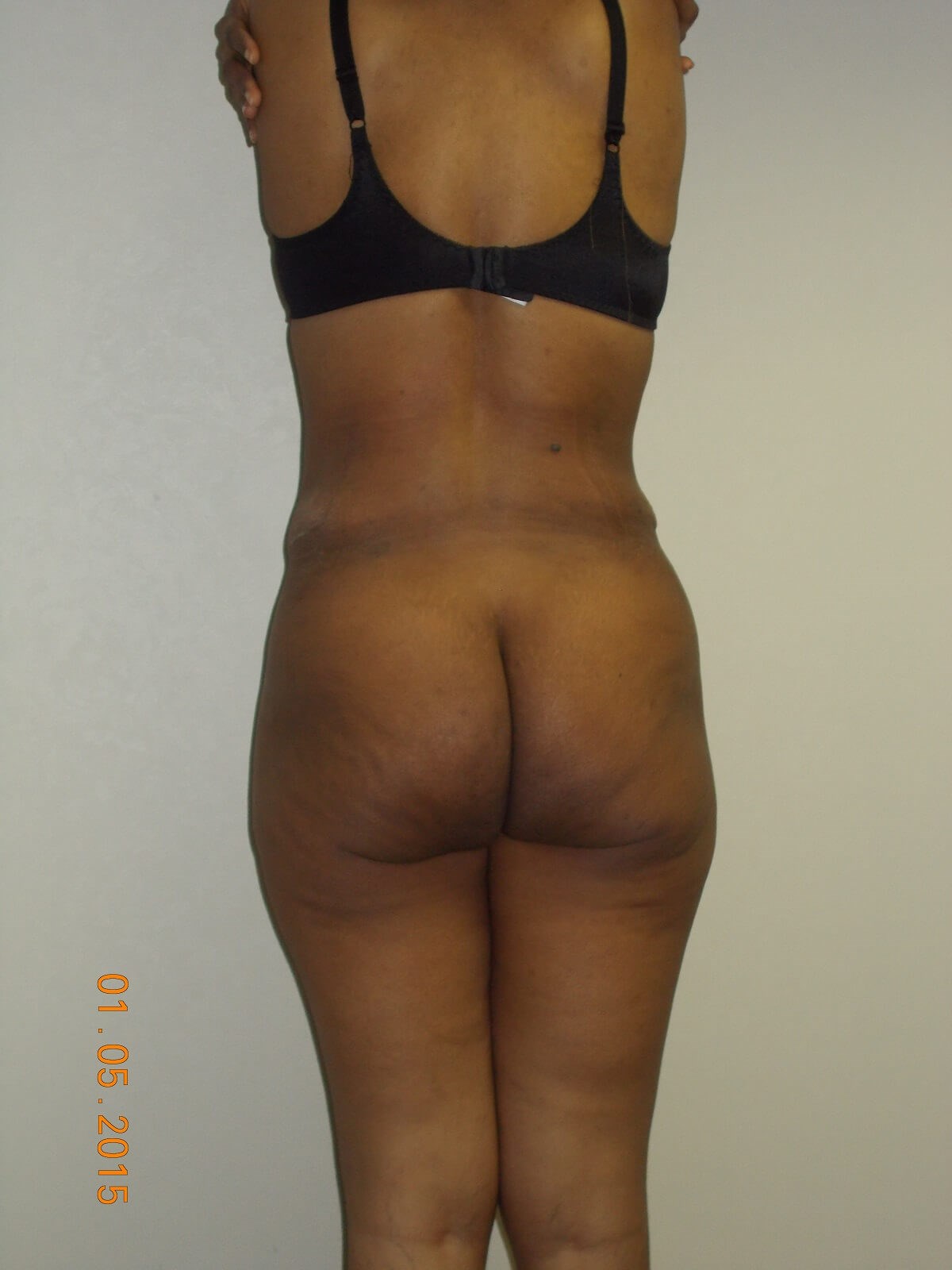 Back View After