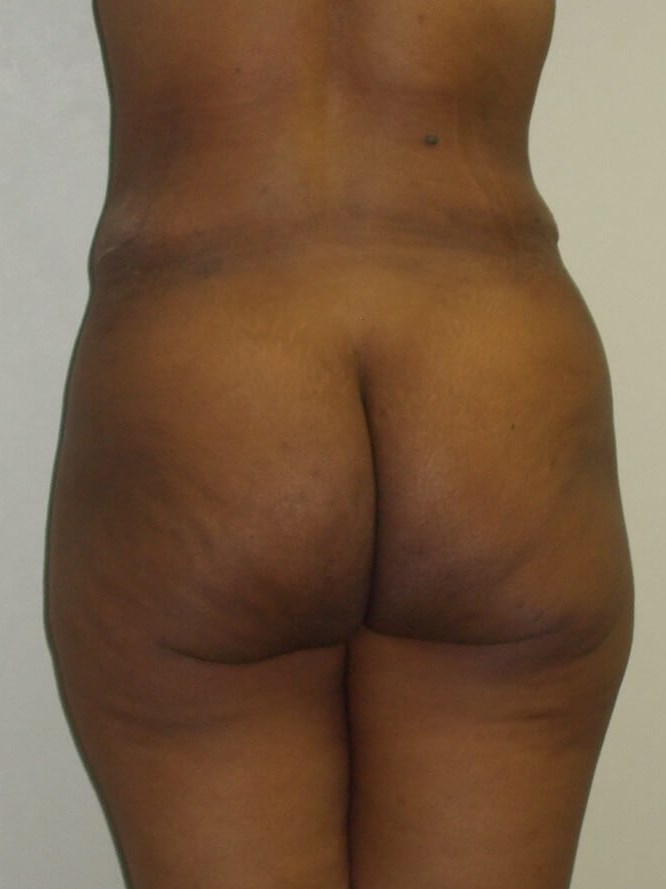 Back View After