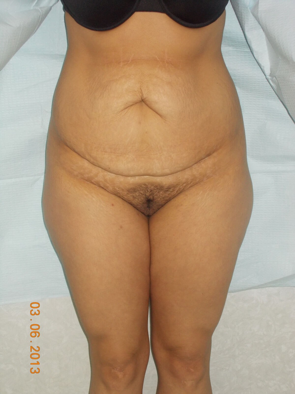 Before Image