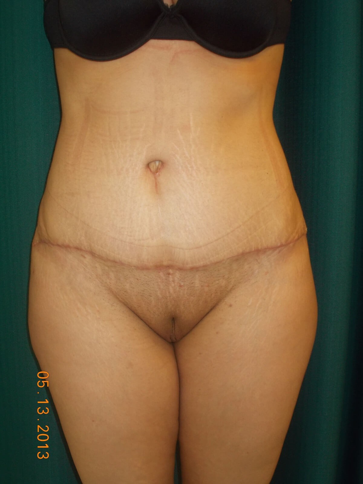 After Image