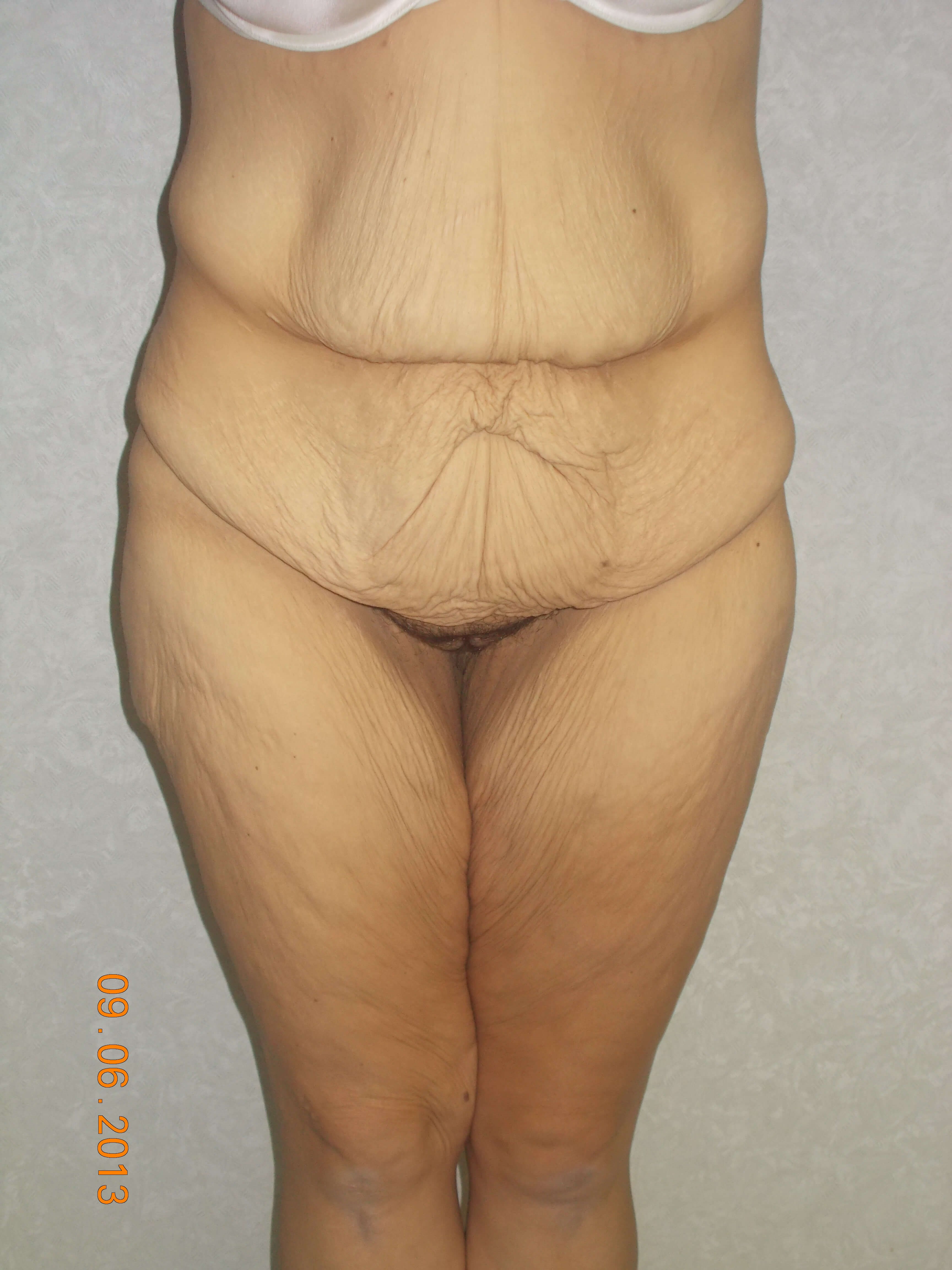 Before Image