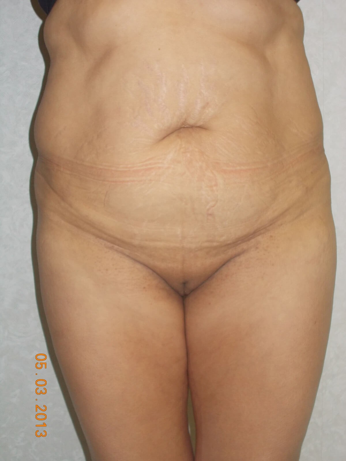 Before Image