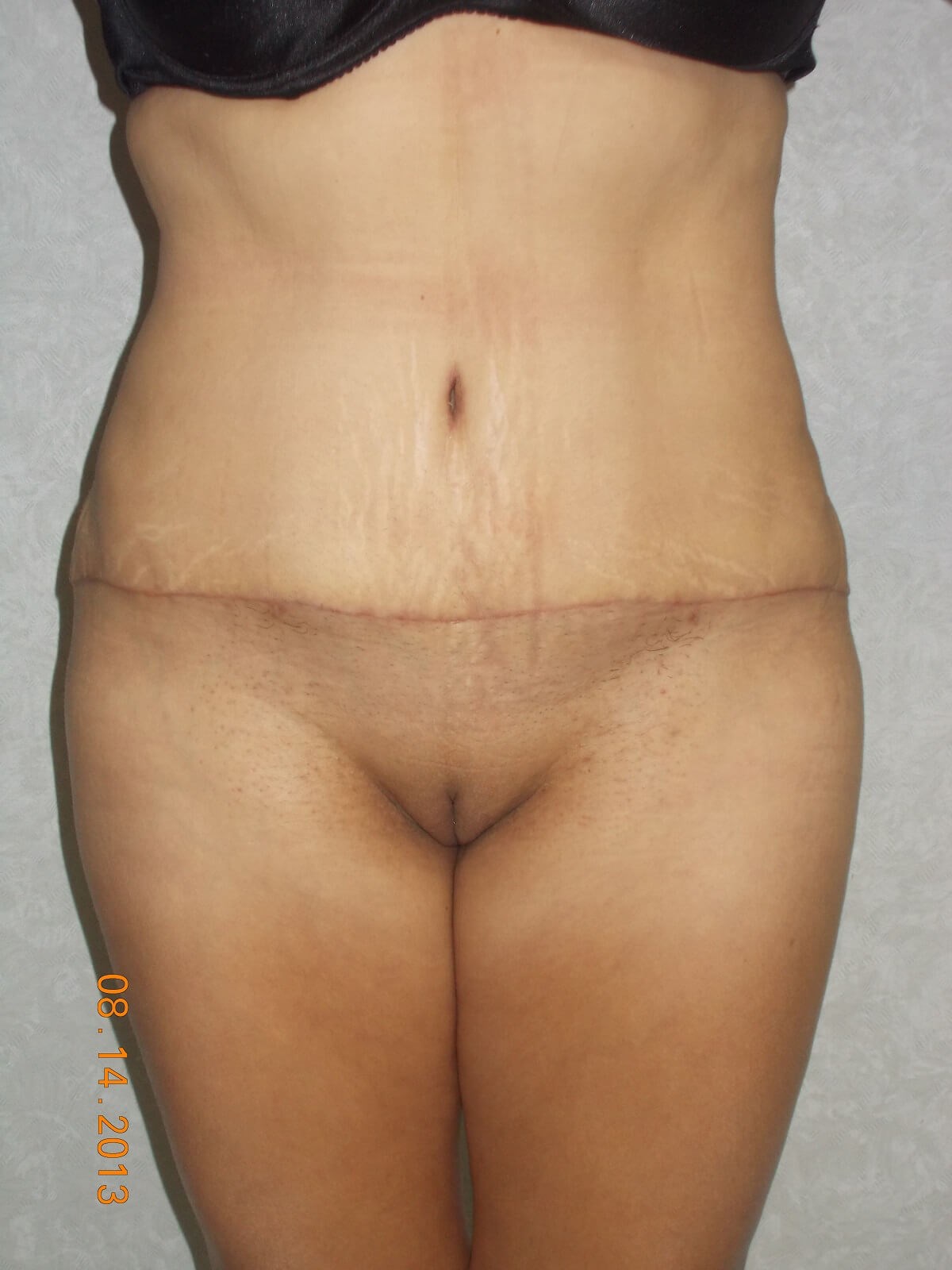After Image