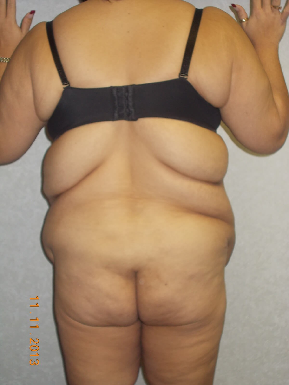 Back View Before