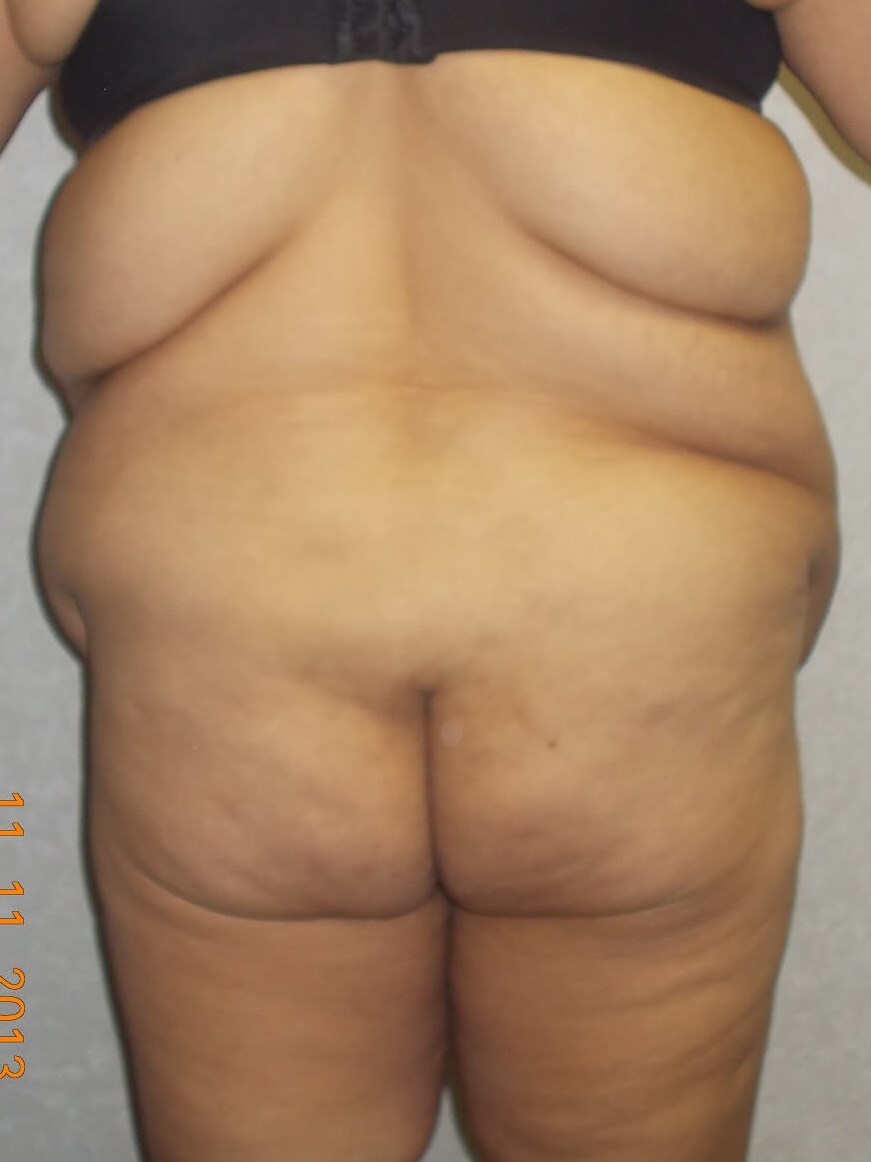 Back View Before