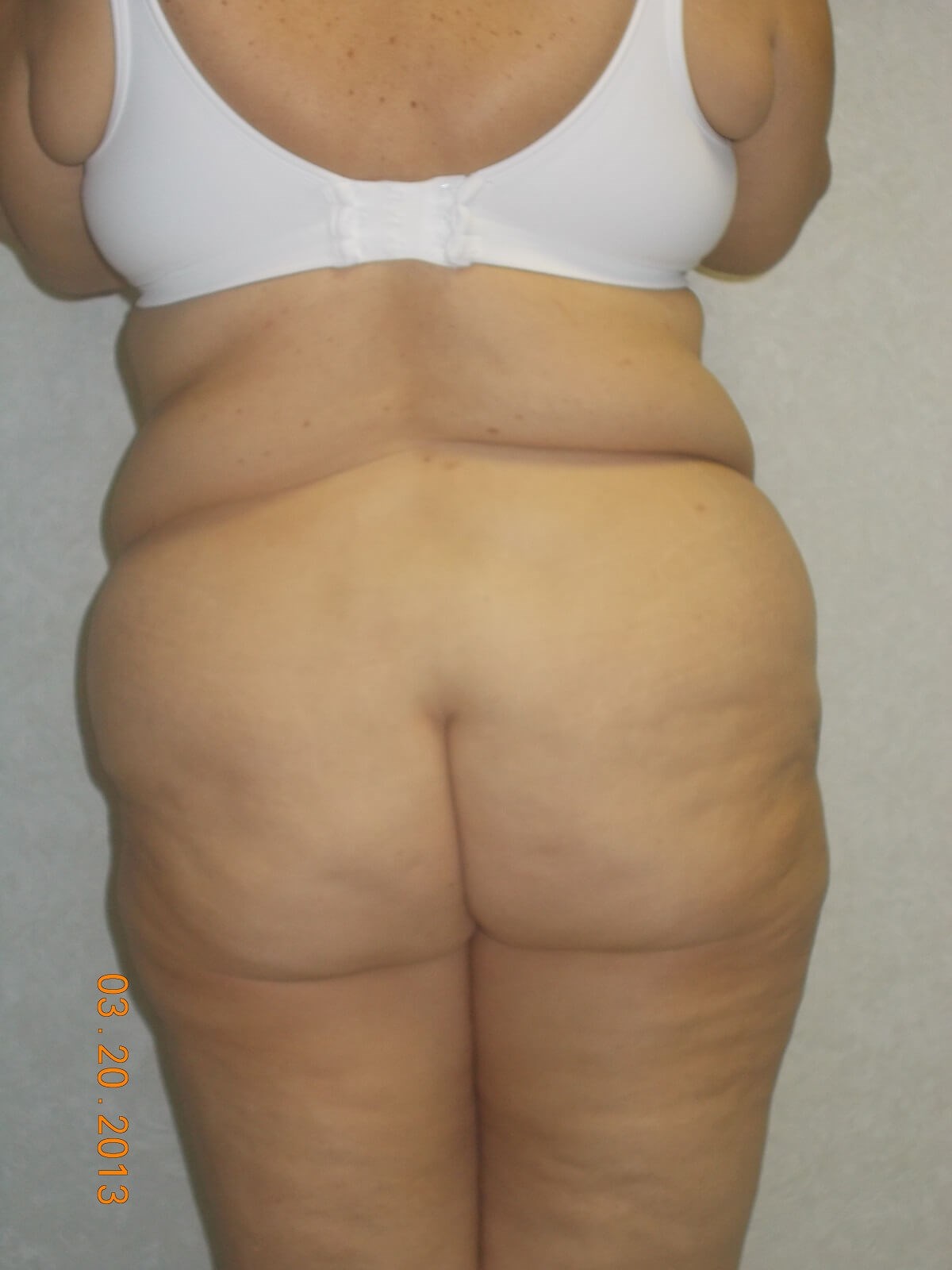 Back View Before