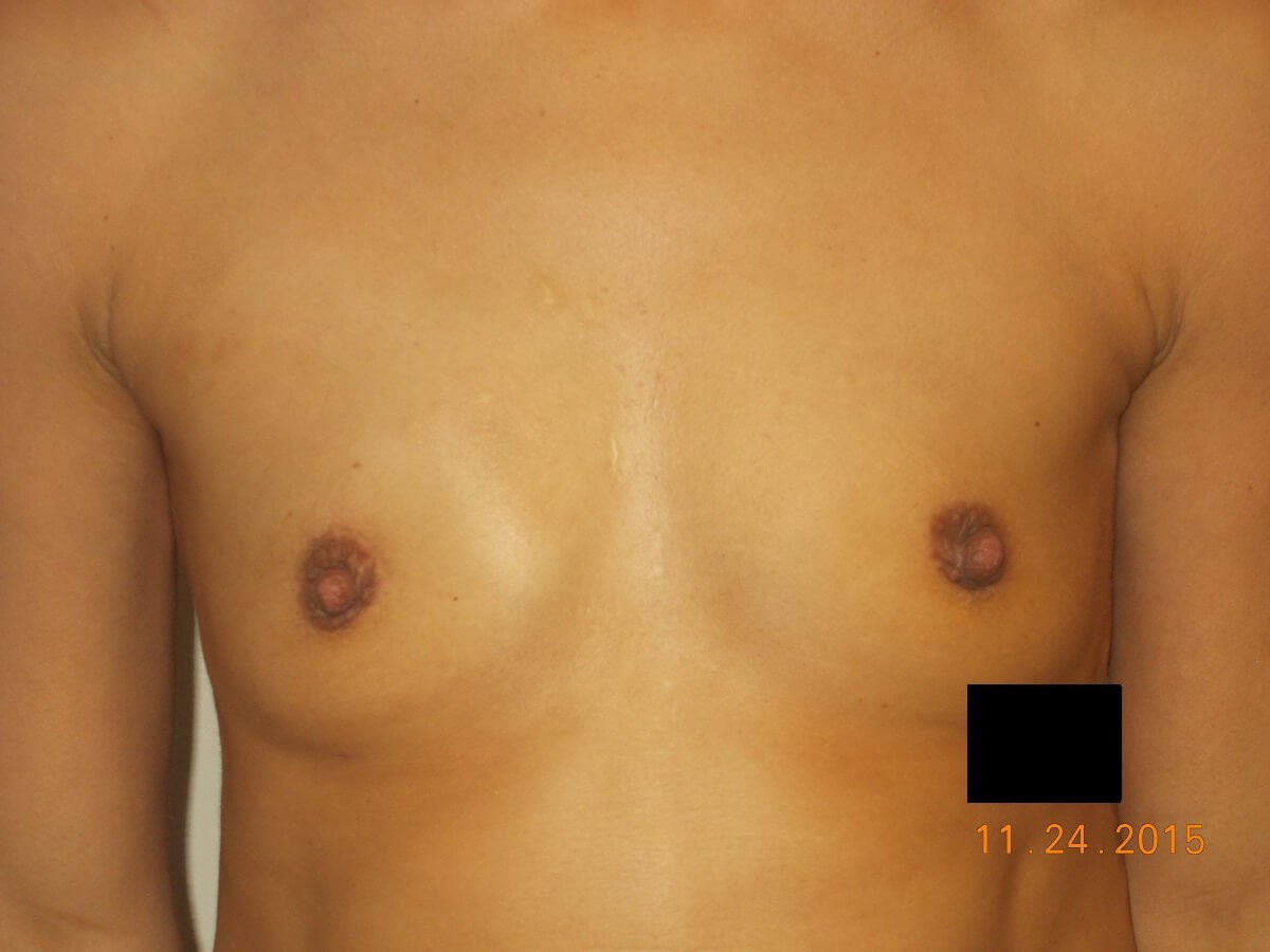 Before Image