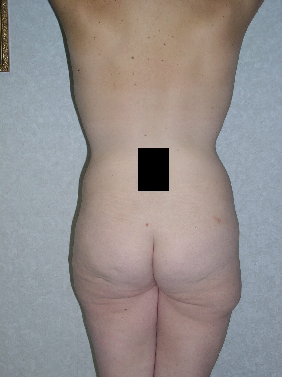 Back View Before