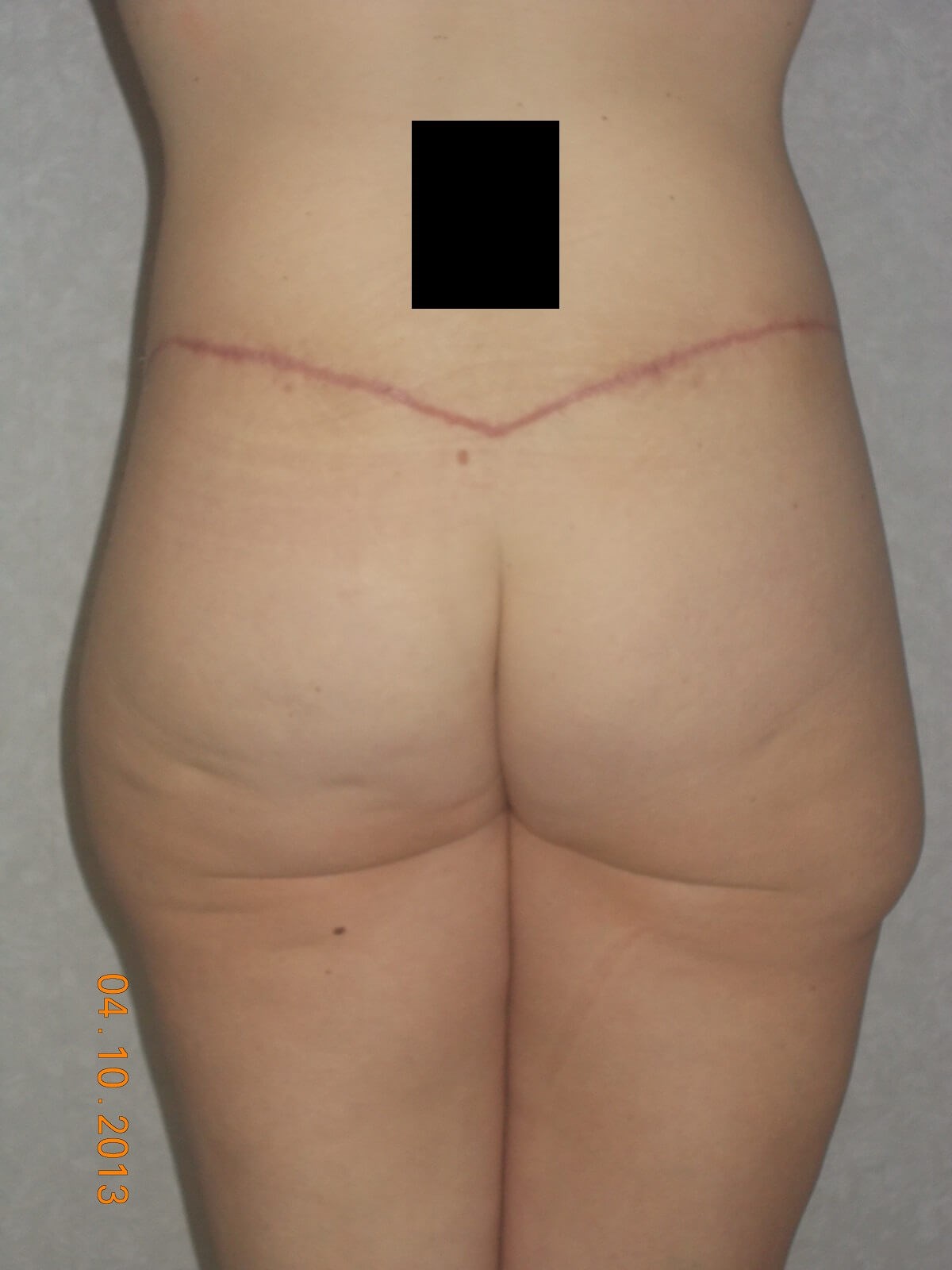 Back View After