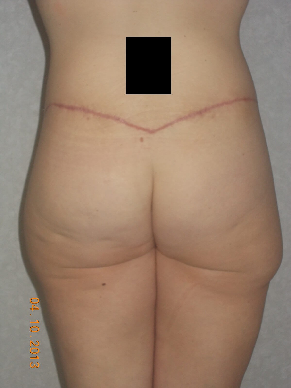 Back View After