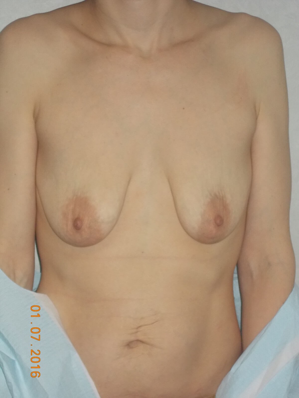 Before Image