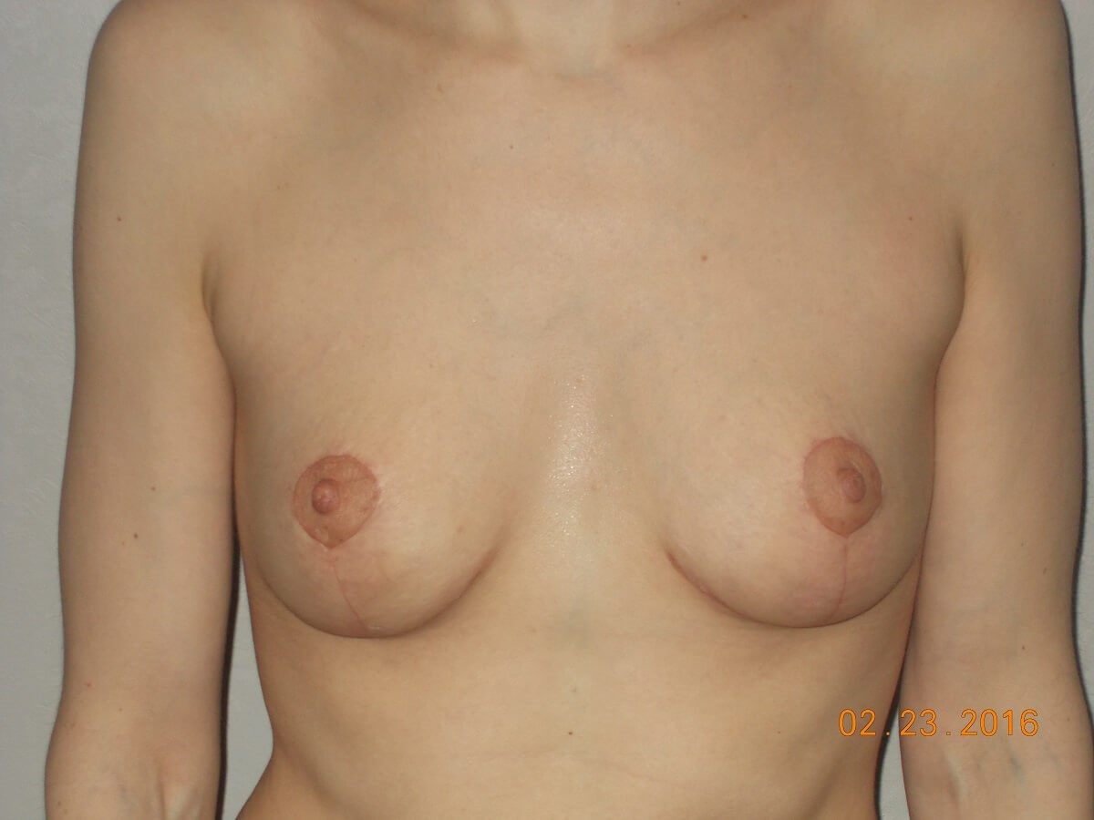 After Image