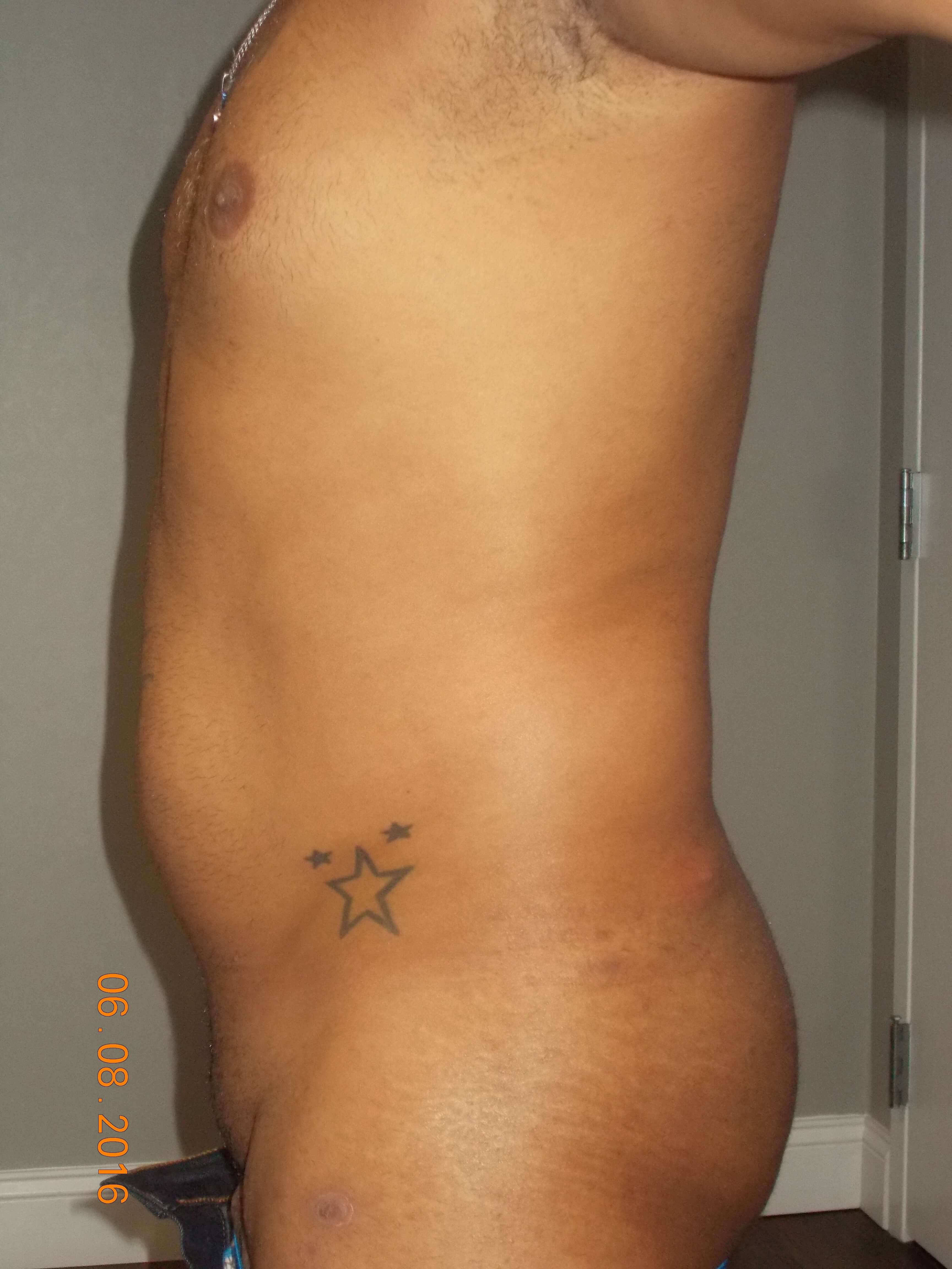 Side View Before