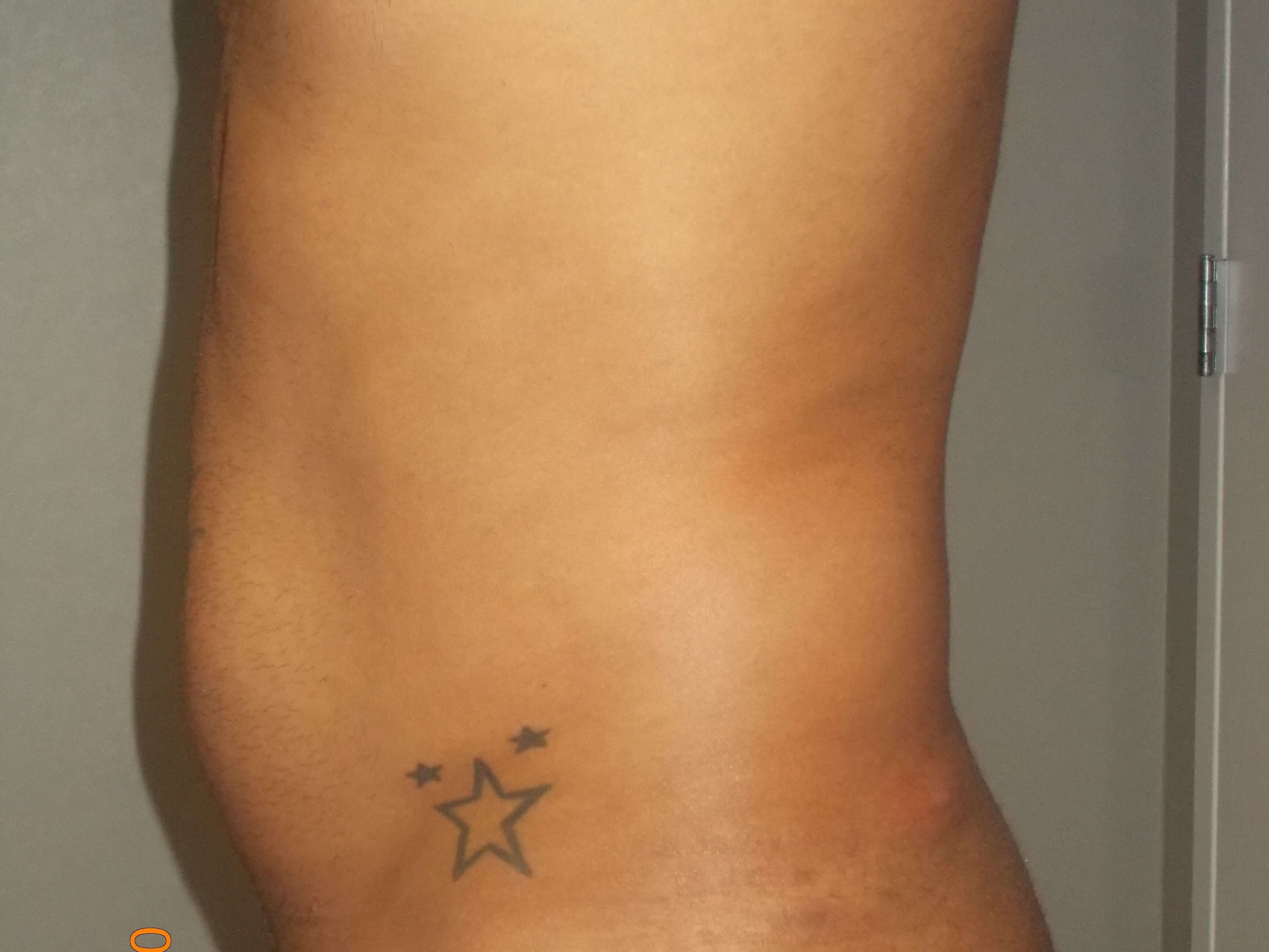 Side View Before