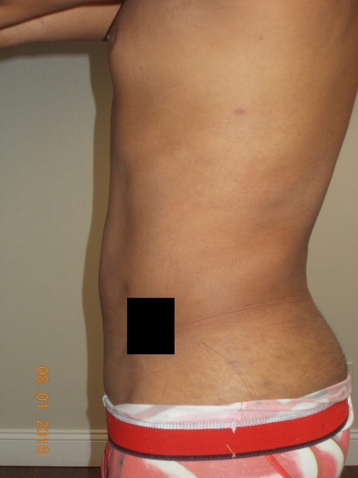 Side View After