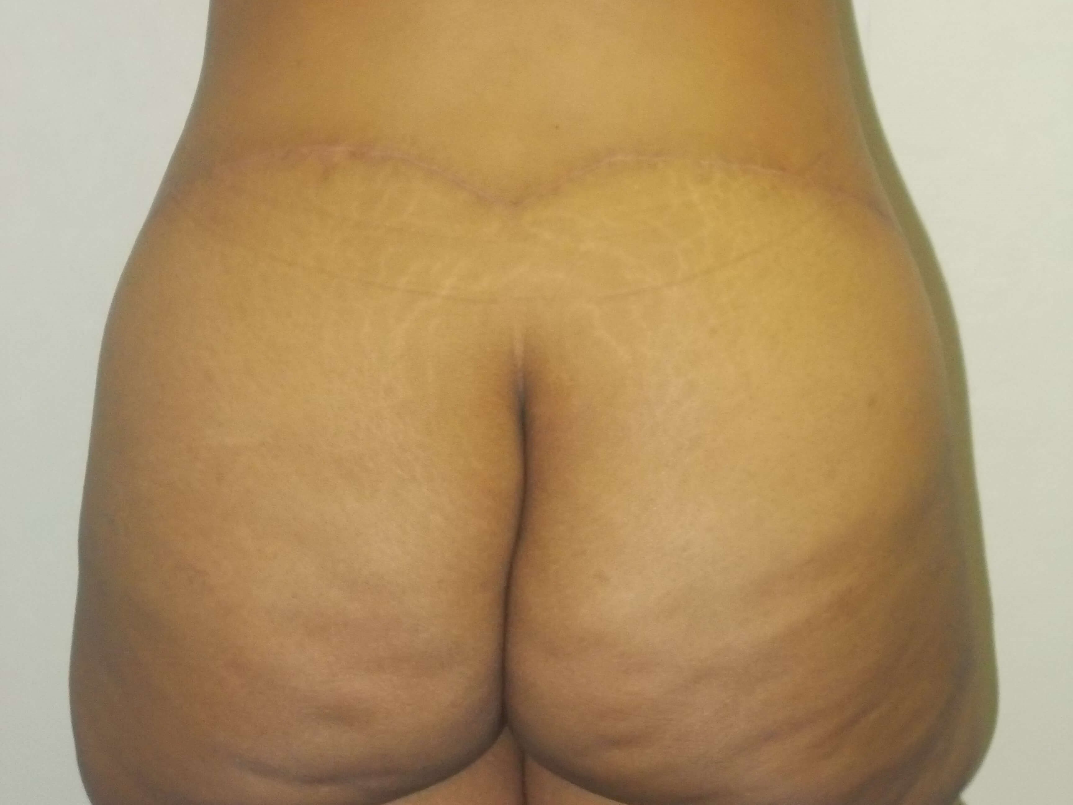 Back View After