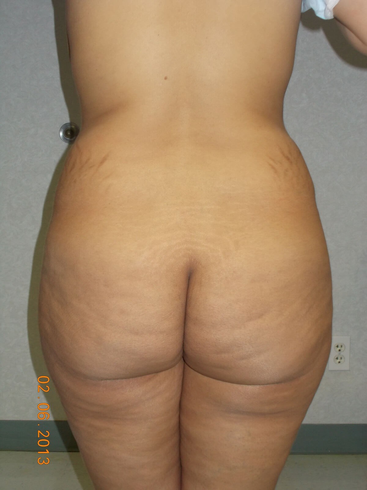 Back View Before
