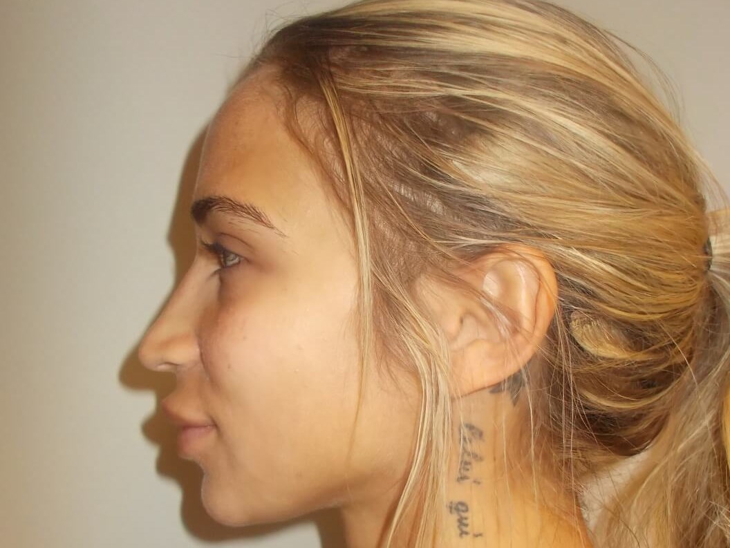 Side View After