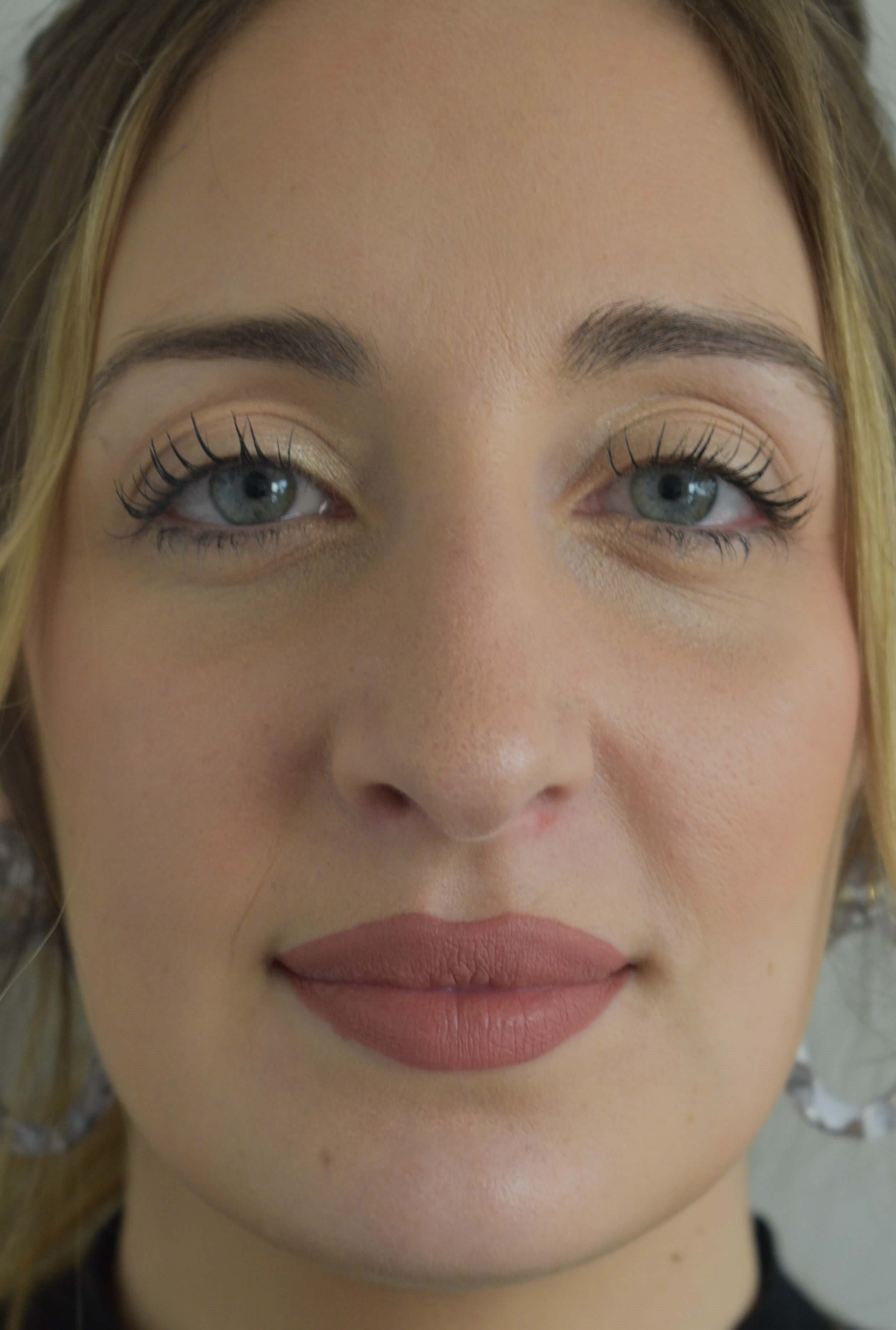 Rhinoplasty form and function After